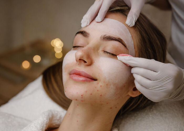 Jak rozpoznać rodzaj trądziku i dobrać odpowiednie leczenie?